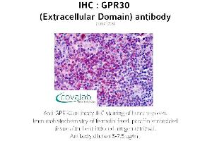 Image no. 1 for anti-G Protein-Coupled Estrogen Receptor 1 (GPER) (2nd Extracellular Domain) antibody (ABIN1735051)