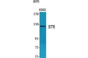 Image no. 2 for anti-Suppression of Tumorigenicity 5 (ST5) (Internal Region) antibody (ABIN3187070)