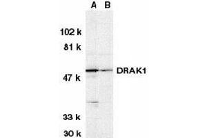 Image no. 2 for anti-serine/threonine Kinase 17a (STK17A) (N-Term) antibody (ABIN499768)