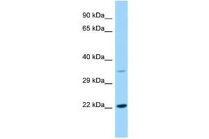 Image no. 1 for anti-KDEL (Lys-Asp-Glu-Leu) Endoplasmic Reticulum Protein Retention Receptor 2 (KDELR2) (Middle Region) antibody (ABIN2790797)