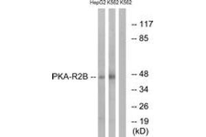 Western blot analysis of extracts from K562/HepG2 cells, using PKA-R2 beta (Ab-113) Antibody.