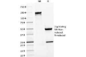 Image no. 5 for anti-CD22 Molecule (CD22) (AA 52-178) antibody (ABIN6941121)