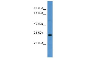 WB Suggested Anti-SPRED2 Antibody Titration: 0.