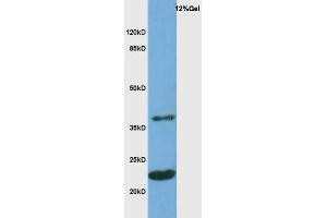 Image no. 2 for anti-Myelin Oligodendrocyte Glycoprotein (MOG) (AA 35-55) antibody (ABIN668481)