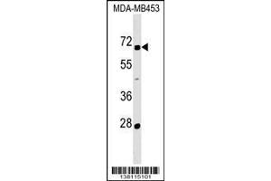 Image no. 1 for anti-Zinc Finger Protein 565 (ZNF565) (AA 69-95), (N-Term) antibody (ABIN1539545)