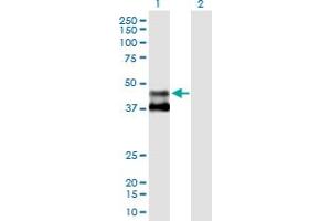 Image no. 1 for anti-Methylmalonic Aciduria (Cobalamin Deficiency) Type A (MMAA) (AA 1-418) antibody (ABIN531168)