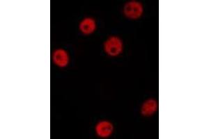 Image no. 1 for anti-Histone Cluster 2, H4a (HIST2H4A) (Lys20) antibody (ABIN6266164)