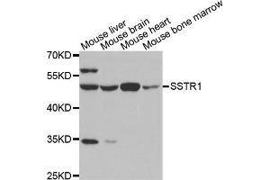 Image no. 1 for anti-Somatostatin Receptor 1 (SSTR1) antibody (ABIN3017440)