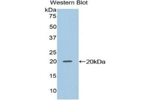 NME2 anticorps  (AA 8-149)