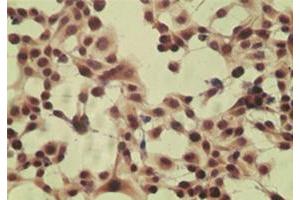 Image no. 2 for anti-Cylindromatosis (Turban Tumor Syndrome) (CYLD) antibody (ABIN537531)