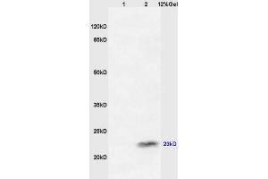 Image no. 4 for anti-Cancer/testis Antigen 2 (CTAG2) (AA 121-210) antibody (ABIN721135)