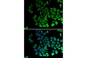 Image no. 1 for anti-Piwi-Like 1 (PIWIL1) antibody (ABIN3023050)