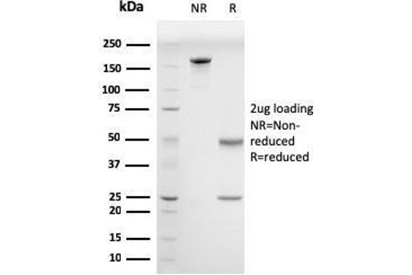 anti-Drebrin 1 (DBN1) (AA 150-281) antibody