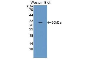 Image no. 2 for anti-Fibrosin (FBS) (AA 1-250) antibody (ABIN5013556)