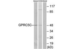 Image no. 1 for anti-G Protein-Coupled Receptor, Family C, Group 5, Member C (GPRC5C) (AA 51-100) antibody (ABIN1535729)