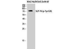 Image no. 1 for anti-Lymphocyte Cytosolic Protein 2 (SH2 Domain Containing Leukocyte Protein of 76kDa) (LCP2) (pTyr128) antibody (ABIN3182680)