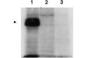 Western blot using  affinity purified anti-MLF1IP antibody shows detection of MLF1IP (arrowhead) in HeLa cells transfected with ZZ-tagged MLF1IP (Lane 1).