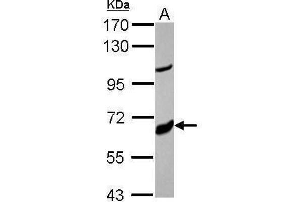 anti-Cytochrome P450, Family 17, Subfamily A, Polypeptide 1 (CYP17A1) (Center) antibody
