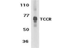 Image no. 2 for anti-Interleukin 27 Receptor, alpha (IL27RA) (C-Term) antibody (ABIN500877)