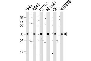 Image no. 5 for anti-Glyceraldehyde-3-Phosphate Dehydrogenase (GAPDH) antibody (ABIN1539789)