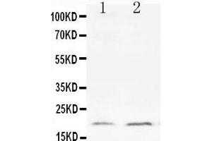 Image no. 1 for anti-BCL2-Like 1 (BCL2L1) (AA 120-130), (Middle Region) antibody (ABIN3043033)