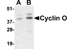 Image no. 1 for anti-Cyclin O (CCNO) (Middle Region) antibody (ABIN1031155)