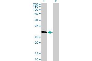 Image no. 2 for anti-Insulin-Like Growth Factor Binding Protein 6 (IGFBP6) (AA 1-240) antibody (ABIN516950)