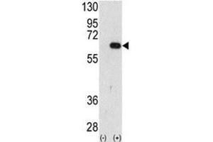 Image no. 6 for anti-Autocrine Motility Factor Receptor (AMFR) (AA 571-601) antibody (ABIN3030083)