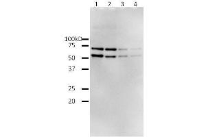 Western Blotting (WB) image for HIV-1 Reverse Transcriptase (HIV1RT) (Active) protein (ABIN7233213)