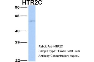Image no. 5 for anti-5-Hydroxytryptamine (serotonin) Receptor 2C (HTR2C) (N-Term) antibody (ABIN2792274)