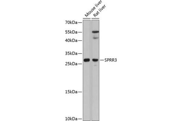 SPRR3 抗体  (AA 1-70)