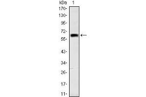 Image no. 5 for anti-Orthodenticle Homeobox 2 (OTX2) antibody (ABIN1108538)