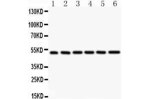 Image no. 1 for anti-Nuclear Factor of kappa Light Polypeptide Gene Enhancer in B-Cells 1 (NFKB1) (AA 1-360) antibody (ABIN3043587)