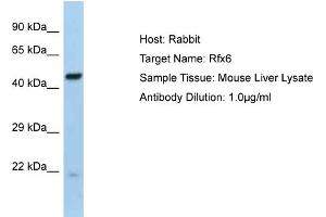 Image no. 1 for anti-Regulatory Factor X 6 (RFX6) (Middle Region) antibody (ABIN2776023)