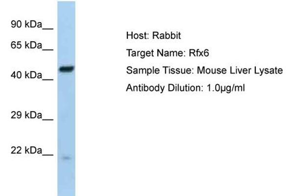 anti-Regulatory Factor X 6 (RFX6) (Middle Region) antibody