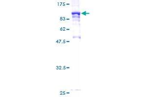 Image no. 1 for Syntaxin Binding Protein 2 (STXBP2) (AA 1-590) protein (GST tag) (ABIN1321813)
