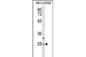 CTRL Antibody (Center) (ABIN1538590 and ABIN2850124) western blot analysis in NCI- cell line lysates (35 μg/lane).