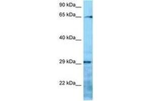 Image no. 1 for anti-Villin-Like (VILL) (AA 176-225) antibody (ABIN6748301)