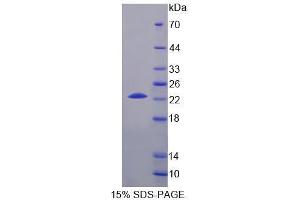 Image no. 1 for Choline Kinase beta (CHKB) (AA 238-394) protein (His tag) (ABIN6239697)