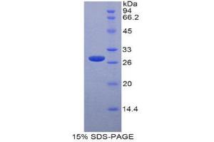 Image no. 1 for Tafazzin (TAZ) (AA 46-239) protein (His tag,T7 tag) (ABIN1877435)
