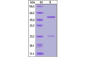 SDS-PAGE (SDS) image for anti-SARS-CoV-2 Spike S1 (RBD) antibody (ABIN6952616)
