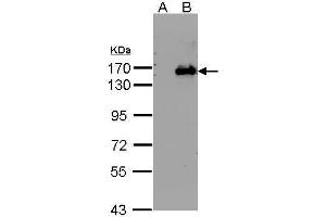 WB Image Western Blot analysis of BRPF1 expression in transfected 293T cell line by BRPF1 polyclonal antibody.