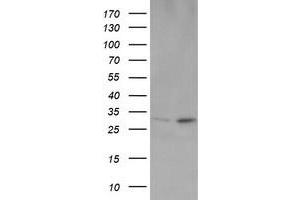 Image no. 2 for anti-OTU Domain, Ubiquitin Aldehyde Binding 1 (OTUB1) antibody (ABIN1499932)