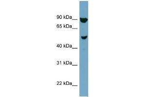Image no. 1 for anti-Iroquois Homeobox Protein 2 (IRX2) (N-Term) antibody (ABIN2783098)