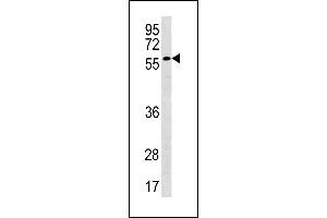 Image no. 1 for anti-Plexin Domain Containing 2 (PLXDC2) (AA 120-147), (N-Term) antibody (ABIN1881663)
