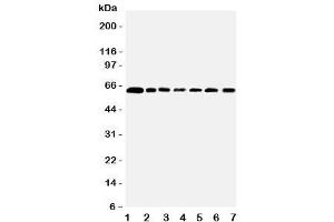 Image no. 2 for anti-Coactivator-Associated Arginine Methyltransferase 1 (CARM1) (Middle Region) antibody (ABIN3030541)
