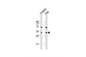 Image no. 4 for anti-Hydroxysteroid (17-Beta) Dehydrogenase 3 (HSD17B3) (AA 89-118) antibody (ABIN653468)