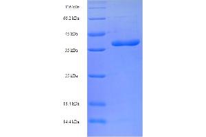 Image no. 1 for BCL2-Like 11 (Apoptosis Facilitator) (BCL2L11) (AA 1-198), (full length) protein (His-SUMO Tag) (ABIN5709129)