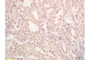 Image no. 1 for anti-Feline Sarcoma Oncogene (FES) (AA 121-220) antibody (ABIN714191)