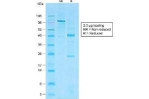 Image no. 1 for anti-CD1a (CD1a) antibody (ABIN6941004)